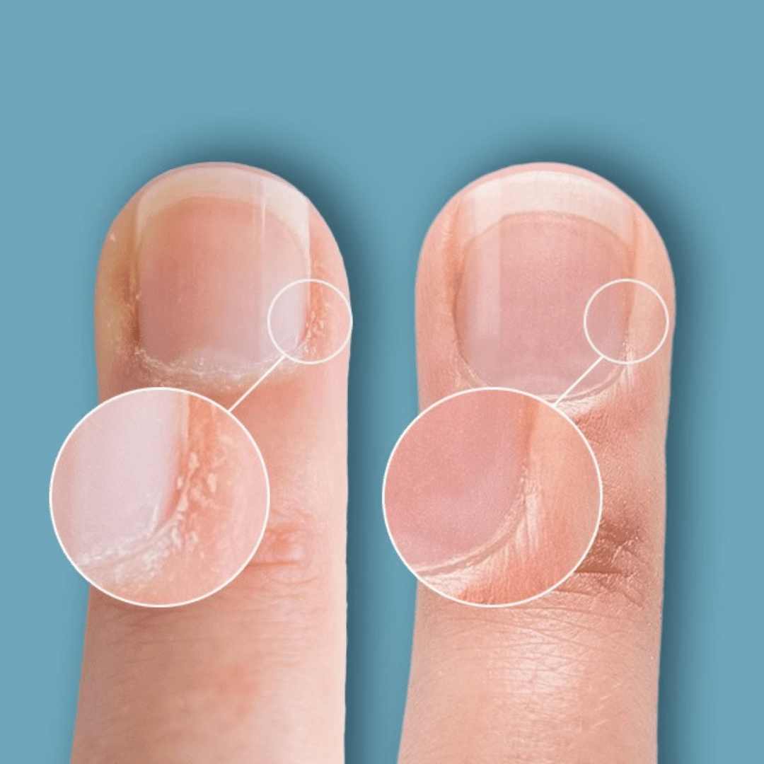 CND™ Cuticle Eraser - Bodylux