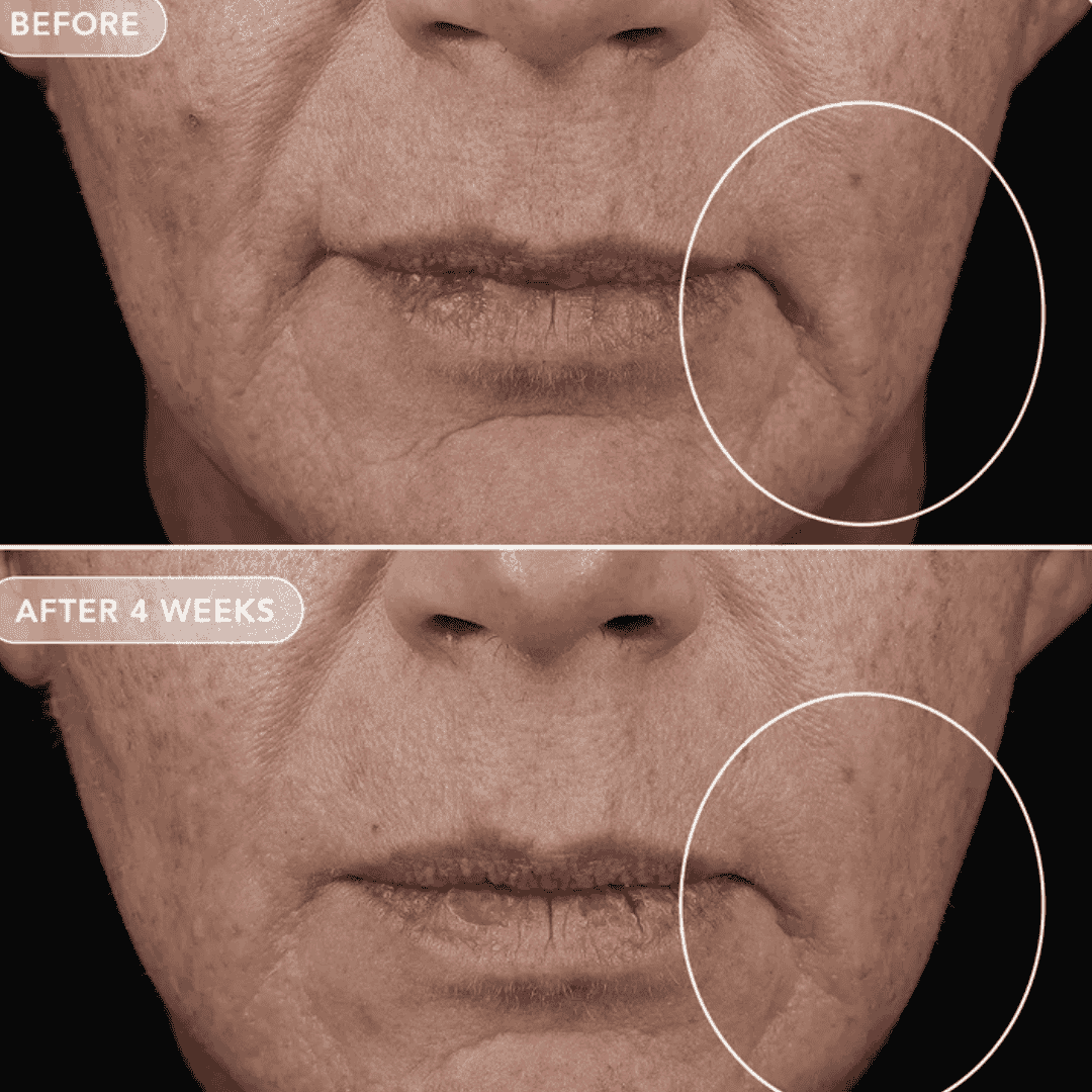 Image Skincare VOL.U.Lift Skin Rebound Complex - Bodylux