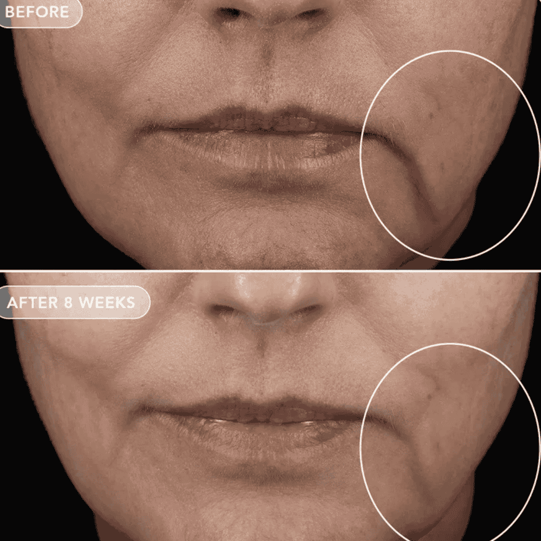 Image Skincare VOL.U.Lift Skin Rebound Complex - Bodylux