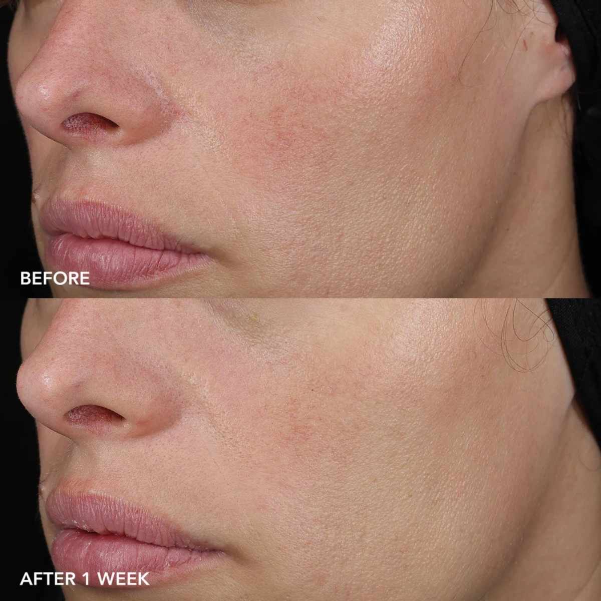 Image Skincare Image MD Barrier Repair Recovery Balm - Bodylux