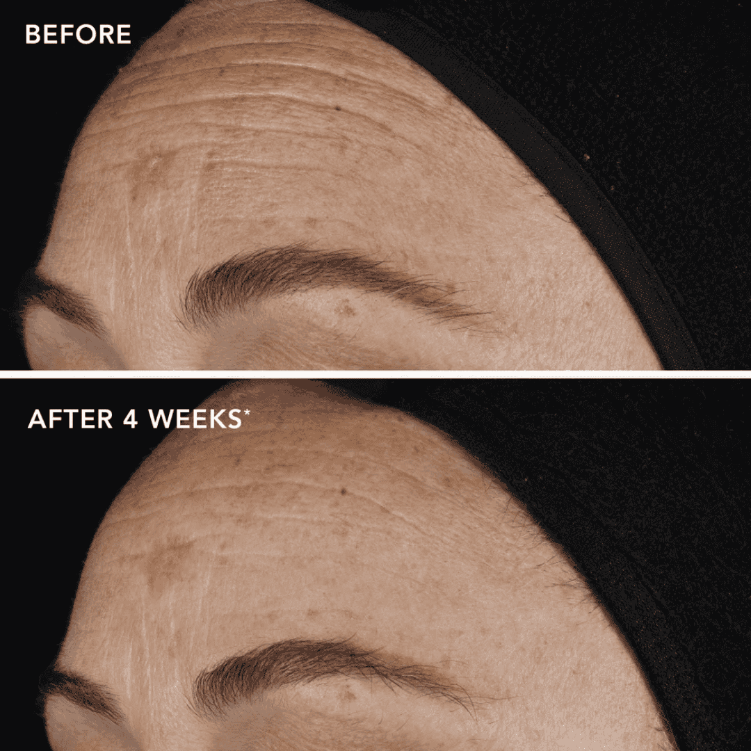 Image Skincare AGELESS+ retinol pure liquid retinol 0.1% - Bodylux