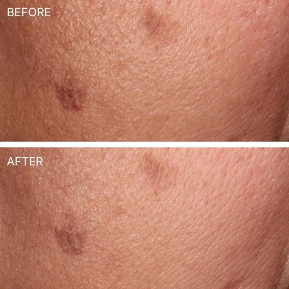 Luminant PHA Essence Toner med eksfolierende PHA
