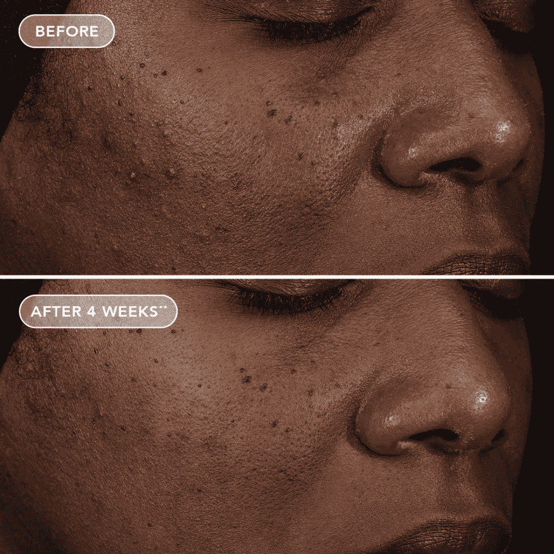 Image Skincare AGELESS+ retinol repair crème 0.3% retinol complex - Bodylux