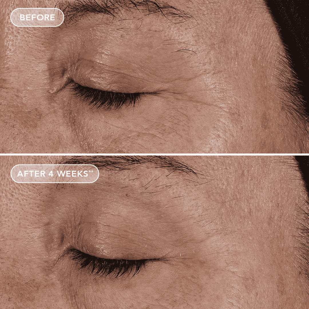 Image Skincare AGELESS+ retinol pure liquid retinol 0.1% - Bodylux