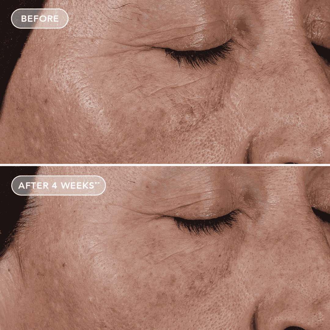 Image Skincare AGELESS+ retinol pure liquid retinol 0.1% - Bodylux