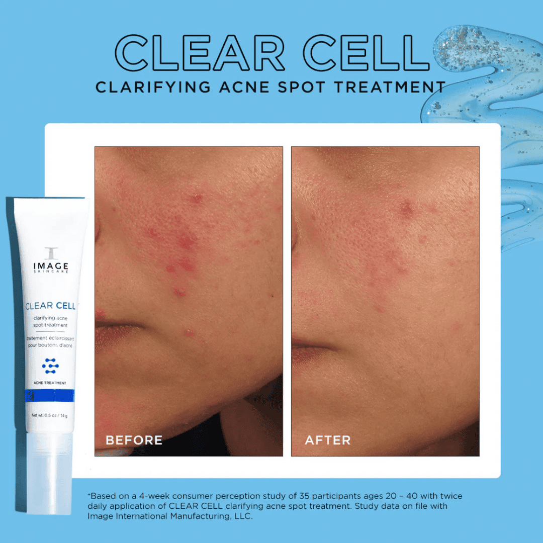 Image Skincare Clear Cell Salicylic Blemish Gel - Bodylux