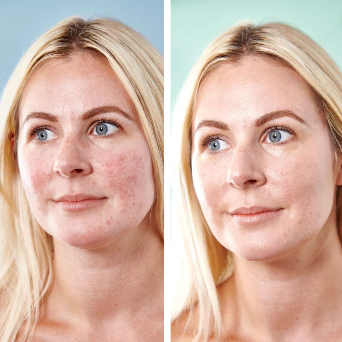 Farvekorrigerende dagcreme med grønne mikrokapsler