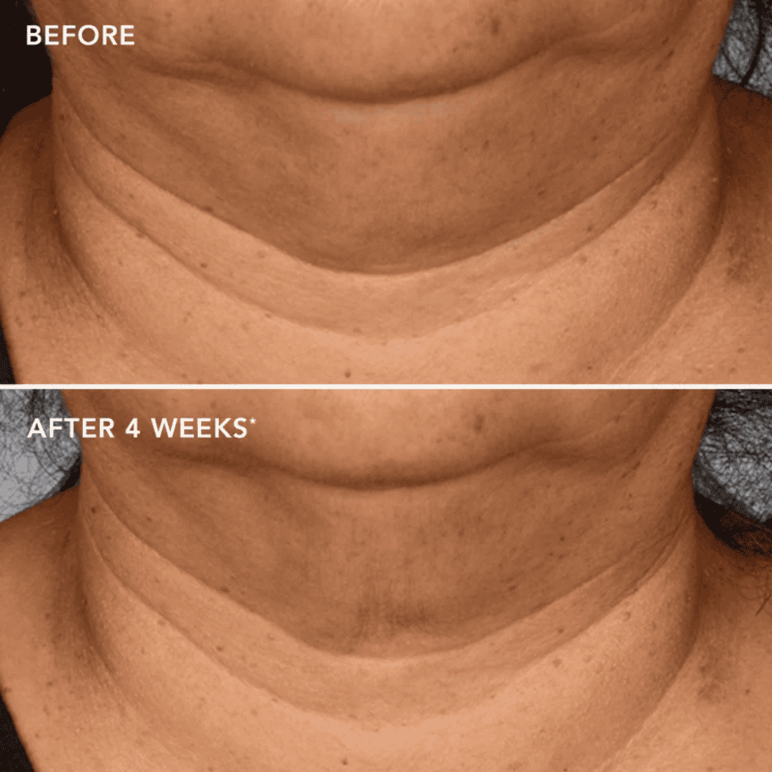 Image Skincare The Max Neck Lift - Bodylux